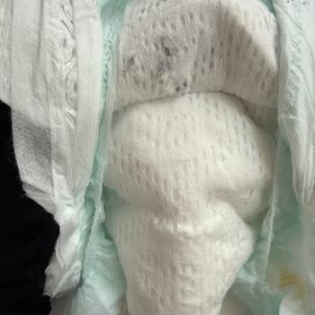 Prima Premium Care 2 Numaralı Bebek Bezinde Siyah Lekeler: Hijyen Ve Sağlık Endişesi