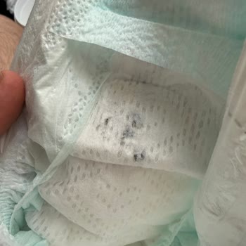 Prima Premium Care 2 Numaralı Bebek Bezinde Siyah Lekeler: Hijyen Ve Sağlık Endişesi