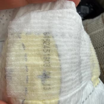 Prima Premium Care 2 Numaralı Bebek Bezinde Siyah Lekeler: Hijyen Ve Sağlık Endişesi