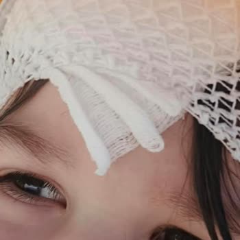 Kaydırak Kazası Ve Güvenlik Eksikliği Nedeniyle Otelde Yaşanan Çoklu Mağduriyetler