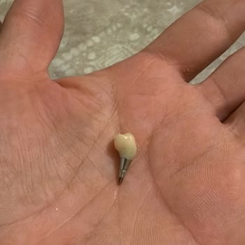 İmpladent Ağız Ve Diş Sağlığı Polikliniği (Gaziantep) Herhangi Bir Telafi Yaklaşımı Göstermediler