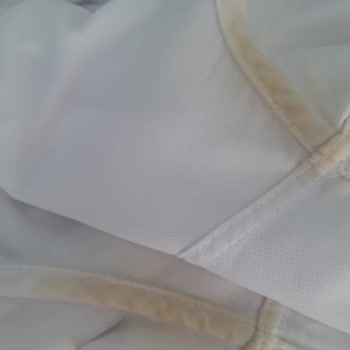 Rossmann Leke Çözücüsü Gömleklerimi Mahvetti, Telafi Edilmeyen Maddi Zarar