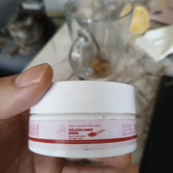 Gülsüm Anne Kremi Cildimde Yoğun Kaşıntı, Tahrişe Sebep Oldu