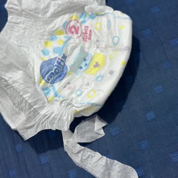 Molfix Bebek Bezinde Seri Hatalı Basım Ve Kullanılamaz Durum