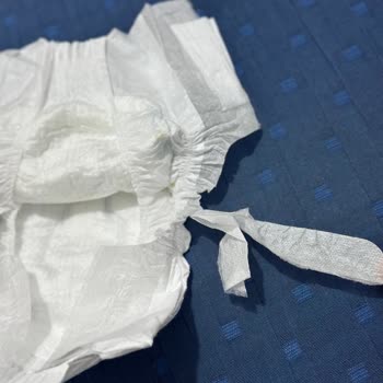 Molfix Bebek Bezinde Seri Hatalı Basım Ve Kullanılamaz Durum