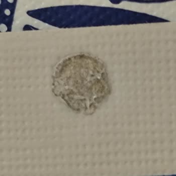 Baskı Hatası Olan Kart Desteği İçin Değişim Ve İade Talebi