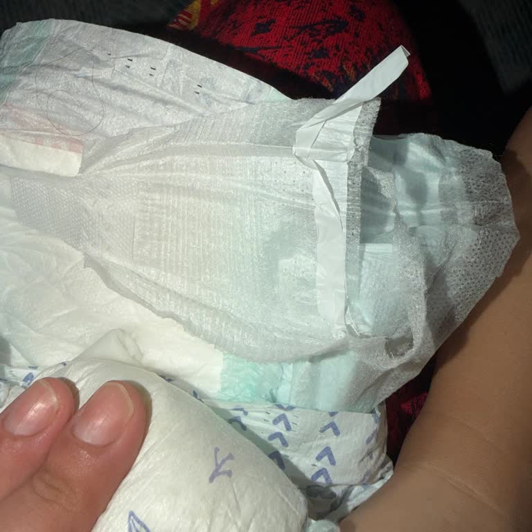 Kalitesiz Ve Çocuk Tahrişi Yapan Baby Me Bebek Bezleri