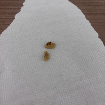 Torku Çikolatalı Gofretten Çıkan Sert Yabancı Cisim