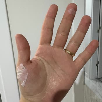 Maylo Tuvalet Kağıdında Sürekli Yırtılma Ve Yapışkan Parçalar Hijyen Sorunu Oluşturuyor