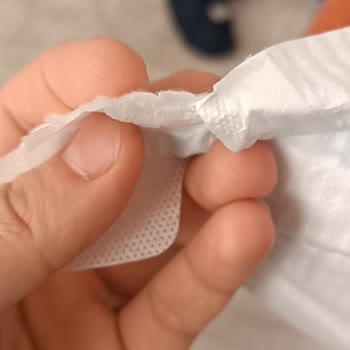 Molfix Bebek Bezinde Yapışkan Cisim Sorunu Ve İade Talebi