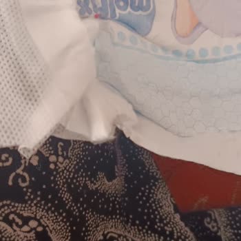 Molfix Bebek Bezinde Yapışkan Cisim Sorunu Ve İade Talebi