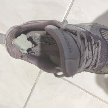 Skechers Ayakkabısının İç Astarı Çabuk Soyuldu, Topuk Deformasyonu Ve Kötü Koku