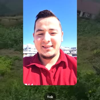 Güneşli Havalarda Kamera Parlaması Nedeniyle Model Değişimi Talebi