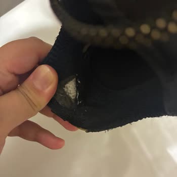 Skechers Ayakkabısında 3 Ayda Topuk Yırtılması Ve Haksız Kullanıcı Hatası Kararı