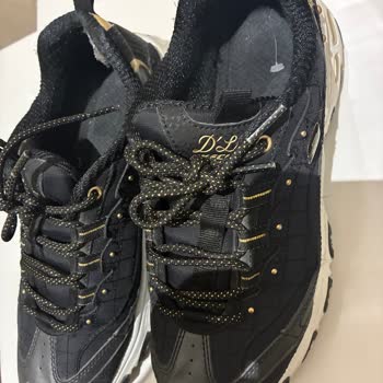 Skechers Ayakkabısında 3 Ayda Topuk Yırtılması Ve Haksız Kullanıcı Hatası Kararı