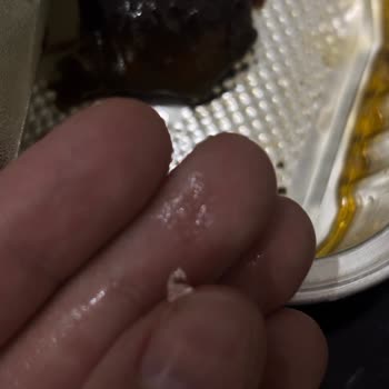 Bebek İçin Aldığım Konserve Sarma’da Cam Parçası Buluştu