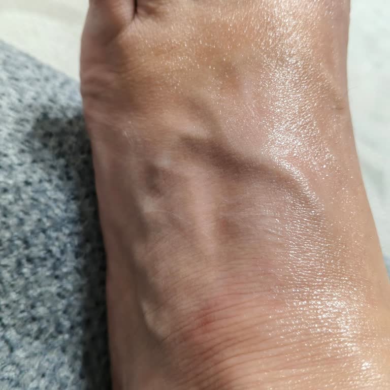 Ayak Uyuşmasına Neden Olan Ayıplı Spor Ayakkabı Ve Mağaza İhmali