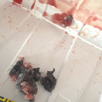 Metro Market Kıymasında Küflü Kalıntı Ve Gıda Güvenliği Endişesi