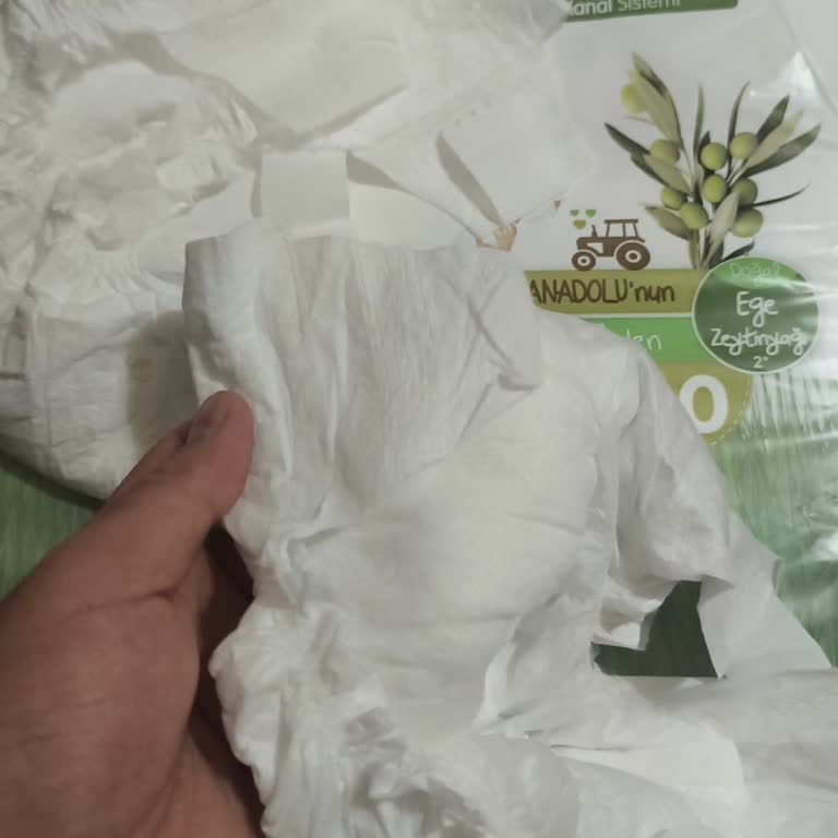 Baby Turco From Nature 4 Maxi Bebek Bezlerinde Bağlama Bantının Sık Kopması