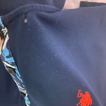 Ayıplı Tişörtlerde Yaka Ve Düğme Bölgesinde Hızlı Yırtılma
