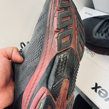 Skechers Ayakkabısında Kısa Sürede Oluşan Delik Ve Parça Kopması Mağaza Kullanıcı Hatası İddiası