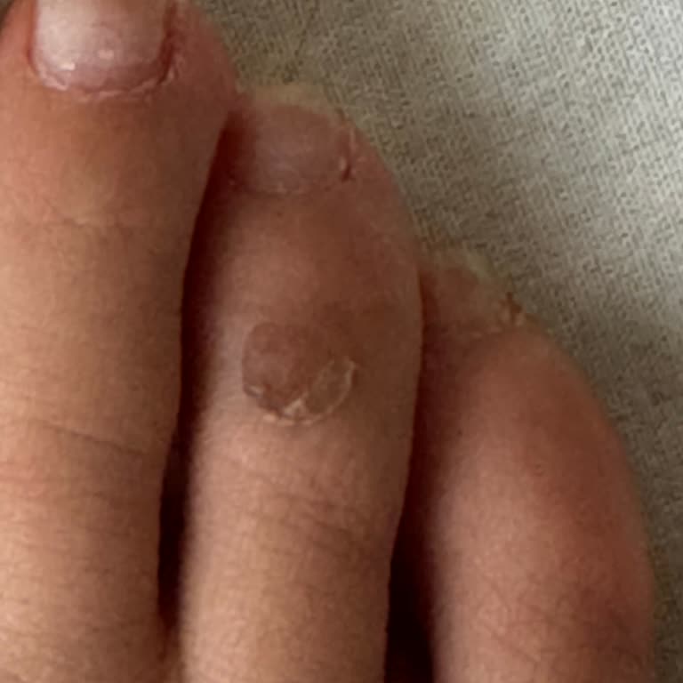 Zara’nın Geciken İade Süreci Ve Ücret İadesi Sorunu