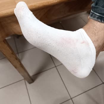 Bordo Boya Sızdıran Adidas Ayakkabı Ve FLO Mağazası Çözüm Sunmuyor