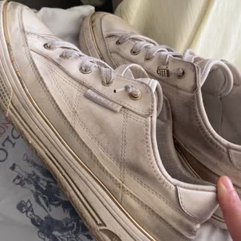 Skechers Ayakkabının Hızlı Kirlenmesi Ve Metal Detayların Renk Solması