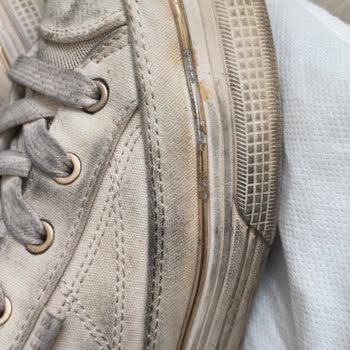 Skechers Ayakkabının Hızlı Kirlenmesi Ve Metal Detayların Renk Solması