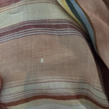 Tekrarlanan Defolu Ürünler Ve Kalite Kontrol Eksikliği