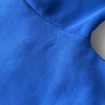 Tek Kullanımla Tiftiklenme Sorunu Ve Yetersiz Müşteri Çözümü