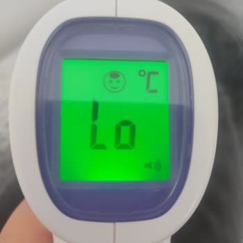 Acura 9270 Temassız Ateş Ölçer Aniden Arızalandı Ve Vücut Sıcaklığı Ölçmüyor