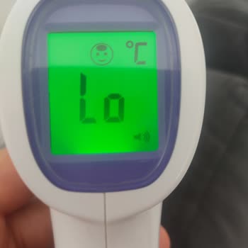 Acura 9270 Temassız Ateş Ölçer Aniden Arızalandı Ve Vücut Sıcaklığı Ölçmüyor