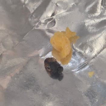 BİM Gazikent Şubesinde Cips Paketi İçinde Sinek Bulunması Hijyen Sorunu