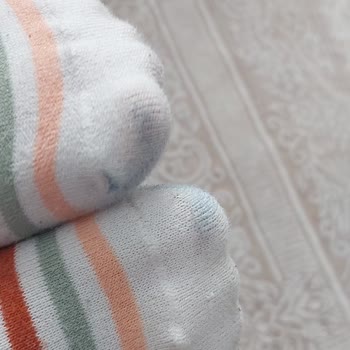 Greyder Ayakkabısının Logo Silinmesi Ve Üst Kısmının Bollaşması