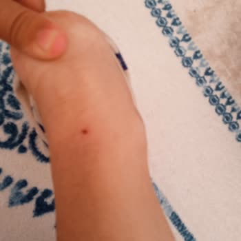 Ayakkabı Tek Gün İçinde Renk Değiştirdi Ağrıya Neden Oldu Ve İade Reddiyle Karşılaştı