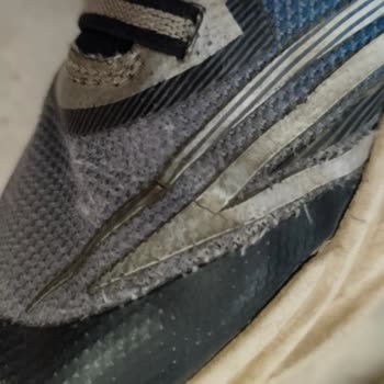 Skechers Çocuk Ayakkabısı Kısa Sürede Yırtıldı, İnceleme Talepleri Red Edildi