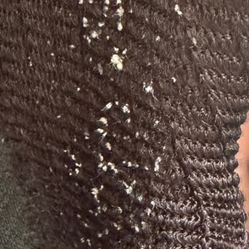 8.600 TL'lik Skechers D’Lites Ayakkabısında İlk Kullanımda Pamuklanma Ve Haksız İnceleme