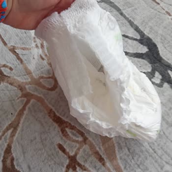 Sleepy Bebek Bezlerinde Üretim Hatası Ve Satış Sonrası Mağduriyet