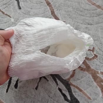 Sleepy Bebek Bezlerinde Üretim Hatası Ve Satış Sonrası Mağduriyet