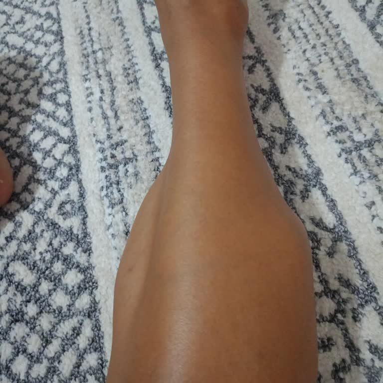 Akm Clinic Dolgu Nedeniyle Oluşan Kitleleşme Ve Ağrı