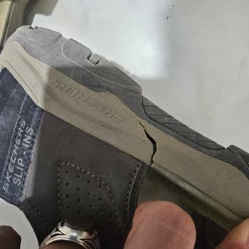 Skechers Sandaletinde Çoklu Yırtılma Ve Üretim Hatası Reddi