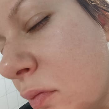 Cilt Yanması Ve Renk Uyumsuzluğu Nedeniyle Ürün İadesi Talebi