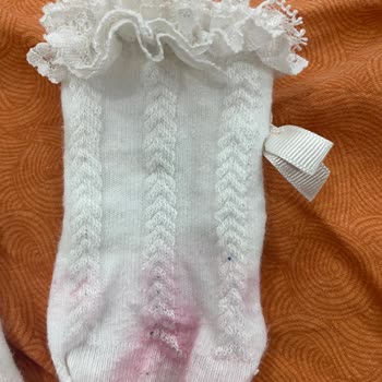Vicco Anka Ayakkabısı Çorabı Pembe Boyadı, Garanti Süresi Dolduğu İçin İşlem Yapılmadı