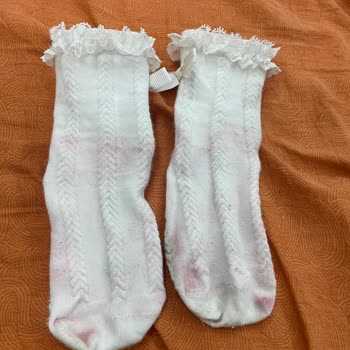 Vicco Anka Ayakkabısı Çorabı Pembe Boyadı, Garanti Süresi Dolduğu İçin İşlem Yapılmadı