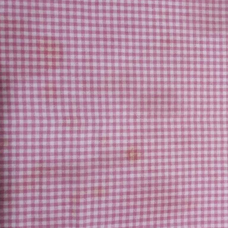 Arçelik Çamaşır Makinesinde Lekeli Çıkarma Sorunu Ve İade Talebimin Reddedilmesi