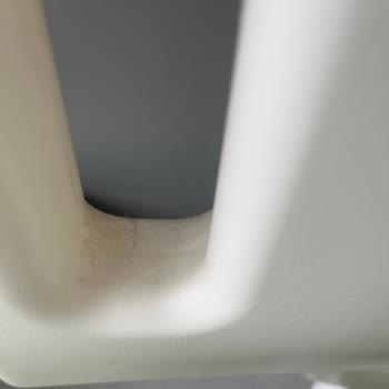 Çocuk Servisi Odasında Hijyen İhlali