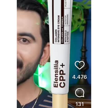 Watsons Göz Kremi Kullanımından Şiddetli Alerjik Şişlik Ve Kaşıntı