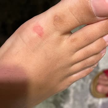 Guess Terlikleri Ayağa Vurdu, Mağaza Kullanıcı Hatası İddiası İle Reddetti