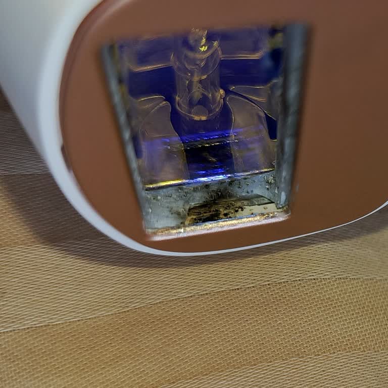 Yanık Ve Koku Sorunlu Lazer Cihazı Garantide Çözülmedi